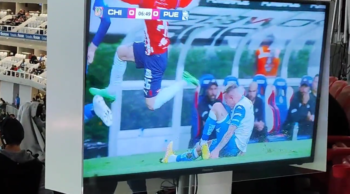¡Fuertes imágenes! La espeluznante lesión en la Liga MX: jugador del Puebla se deshace tobillo en desafortunada entrada