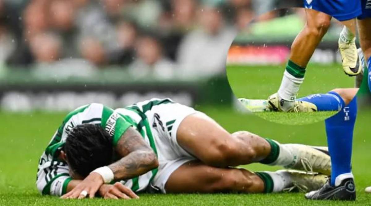 La triste realidad de Luis Palma en el Celtic: ¿Por qué pasó de ser un titular indiscutible a ser marginado por Brendan Rodgers?