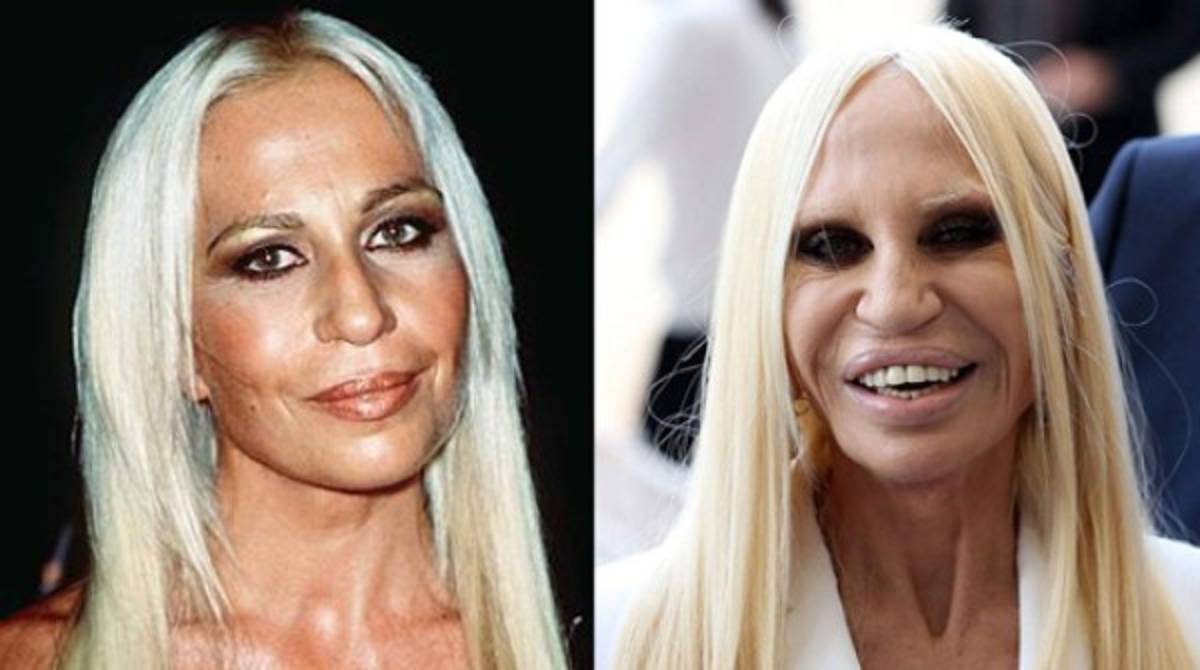 Maradona y las estrellas del espectáculo con tratamiento estético