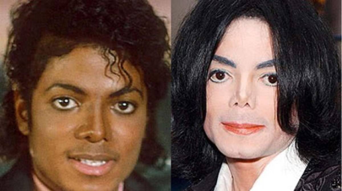 Maradona y las estrellas del espectáculo con tratamiento estético