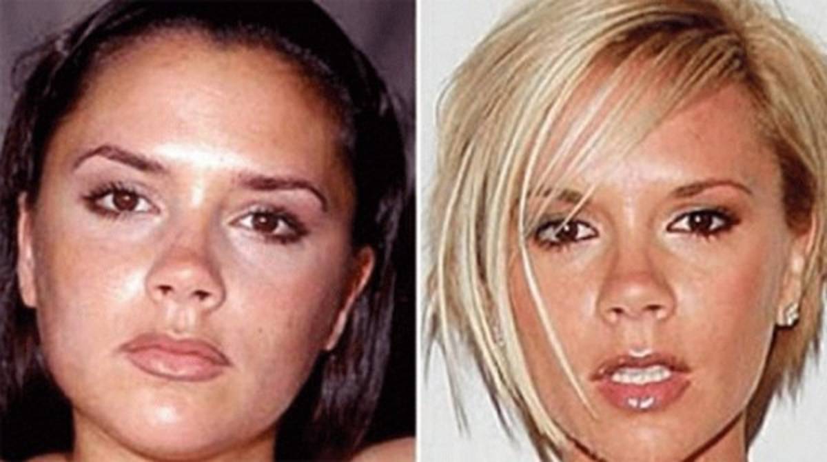 Maradona y las estrellas del espectáculo con tratamiento estético