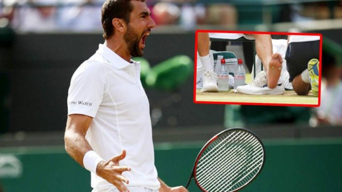 ¡HORRIBLES! Así son los pies más feos de los deportistas famosos