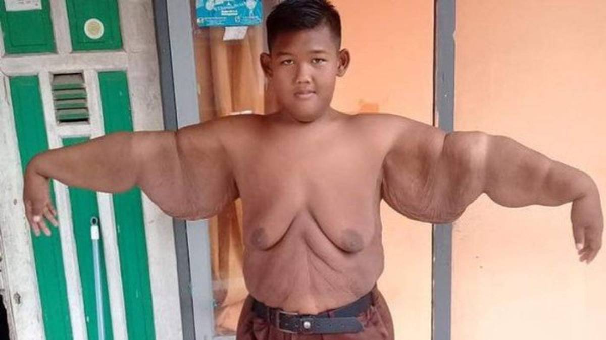 Impresionante: El tremendo cambio físico del niño más obeso del mundo que desea ser futbolista  