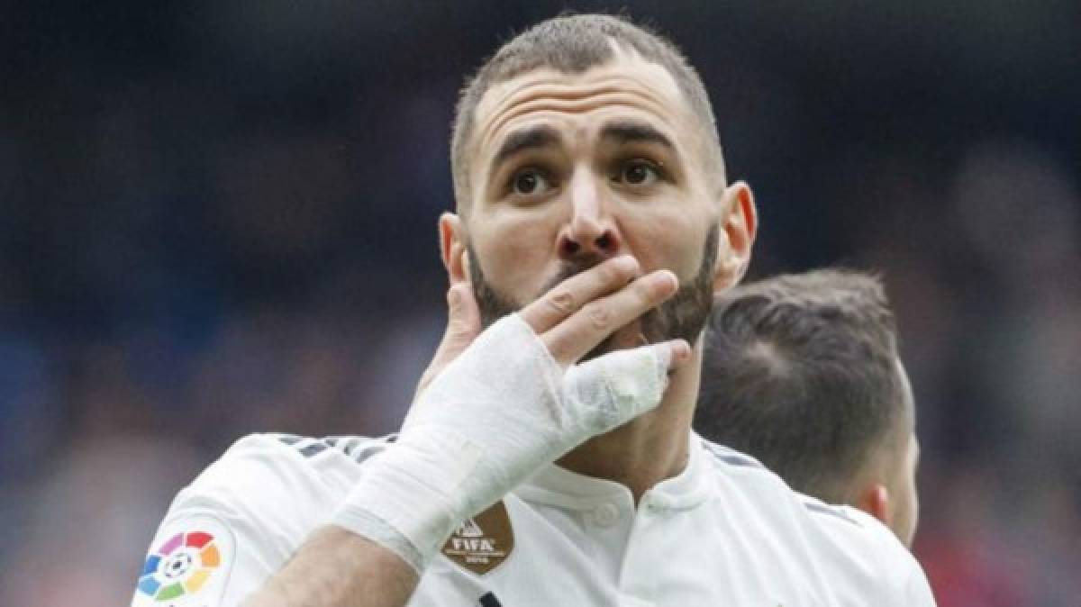 Benzema y la misteriosa lesión en su mano: Así tiene el dedo y aclara por qué no se opera