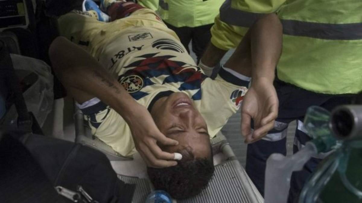 Las impactantes y terroríficas imágenes de la grave lesión de Giovanni dos Santos