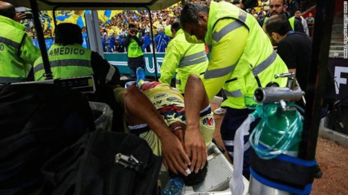 FOTOS: Reconstruyen el muslo de Gio Dos Santos tras lesión en el América-Chivas