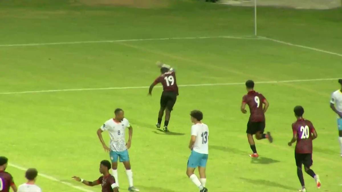 Concacaf: las insólitas rojas que provocó jugador de 1.5 metros por sus trenzas