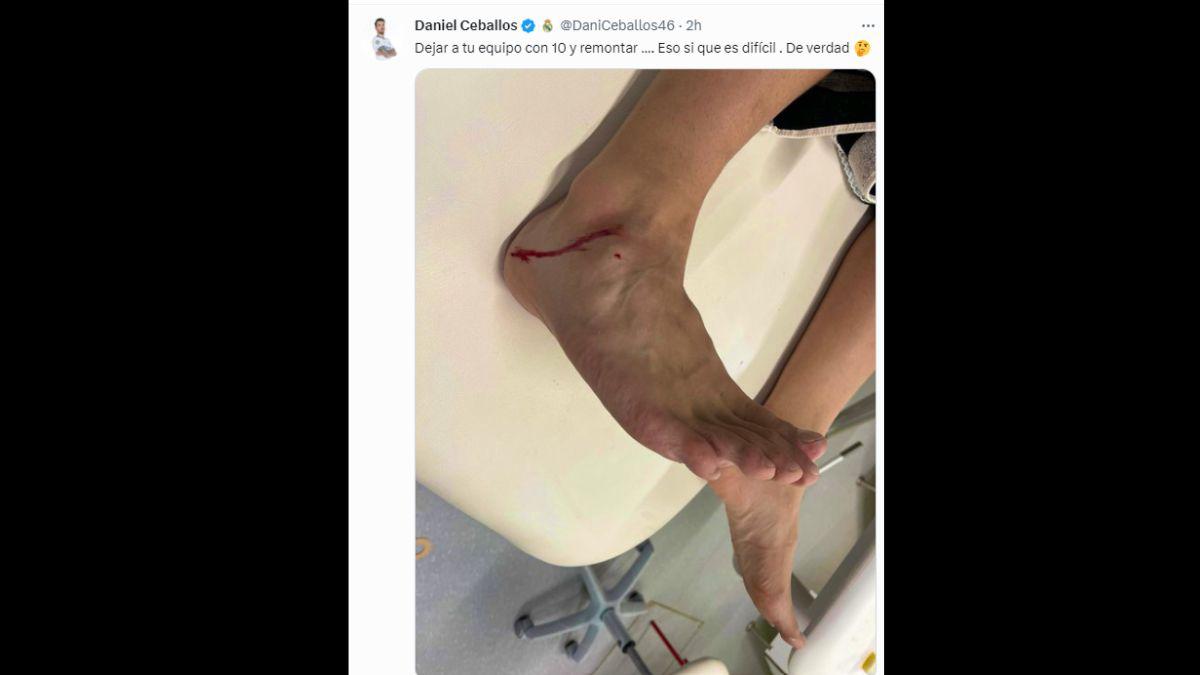 El horrendo golpe a Ceballos tras la entrada salvaje de Acuña en el Sevilla-Real Madrid: “Vergüenza deberías de tener”