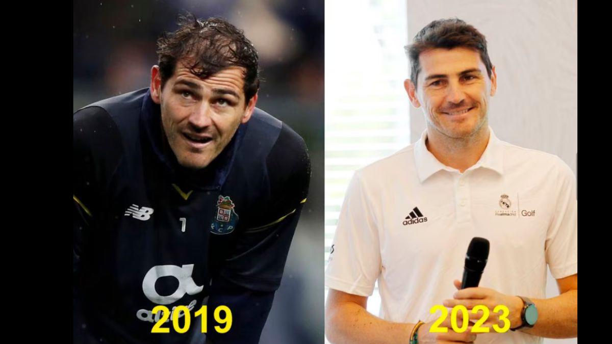 Eran pelones y ahora no: Los jugadores y entrenadores que se han hecho injerto capilar; varios del Barcelona y Real Madrid