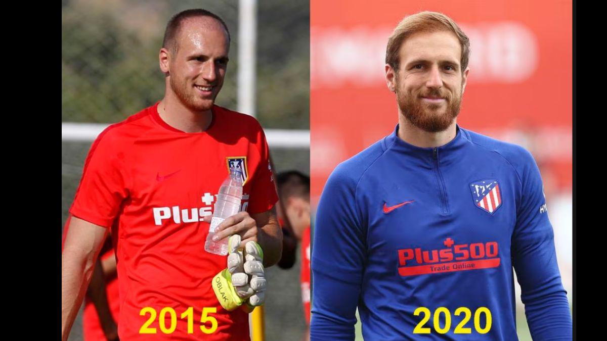 Eran pelones y ahora no: Los jugadores y entrenadores que se han hecho injerto capilar; varios del Barcelona y Real Madrid