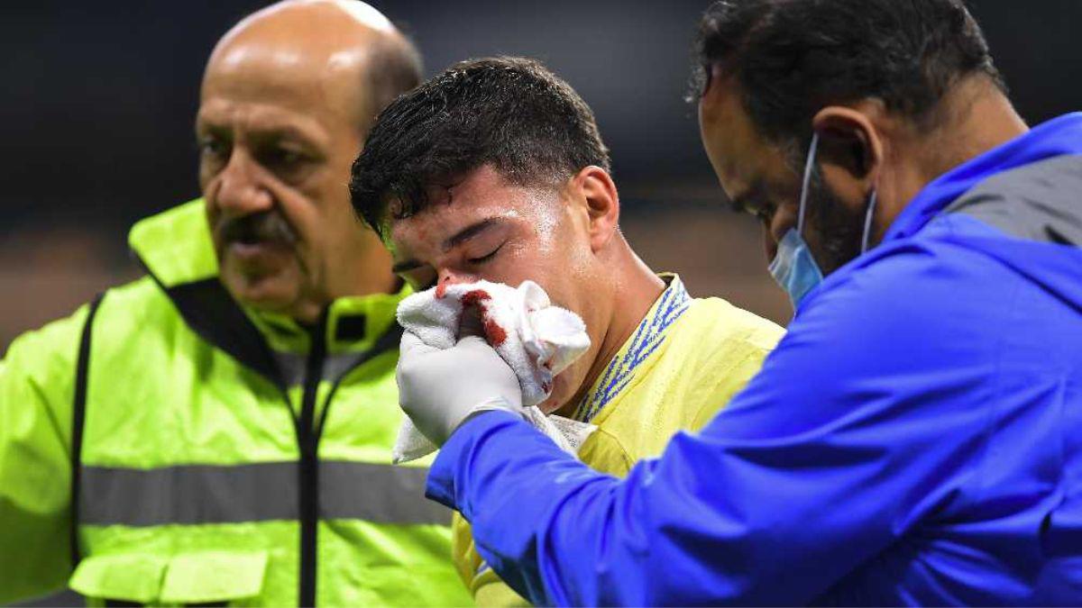 ¡Imágenes sensibles! La dolorosa fractura de nariz de Alex Zendejas en el América- Monterrey ¿Cómo le quedó el golpe?
