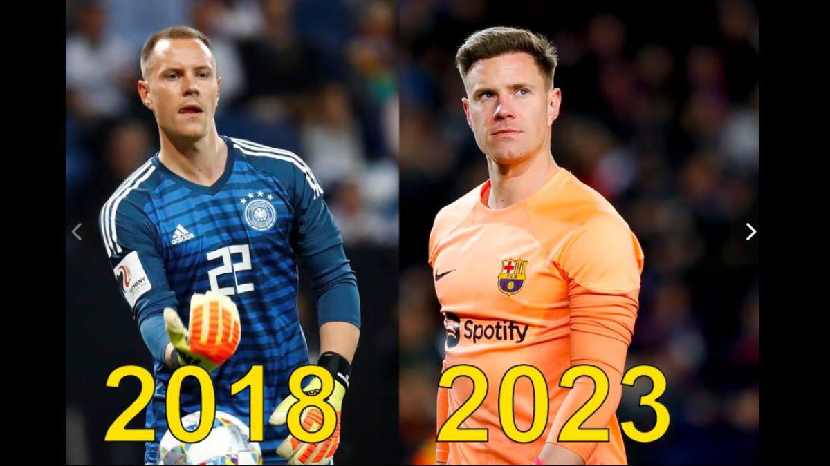 Eran pelones y ahora no: Los jugadores y entrenadores que se han hecho injerto capilar; varios del Barcelona y Real Madrid