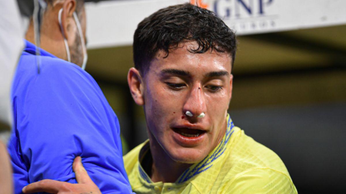 ¡Imágenes sensibles! La dolorosa fractura de nariz de Alex Zendejas en el América- Monterrey ¿Cómo le quedó el golpe?