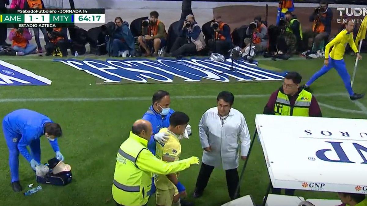 ¡Imágenes sensibles! La dolorosa fractura de nariz de Alex Zendejas en el América- Monterrey ¿Cómo le quedó el golpe?