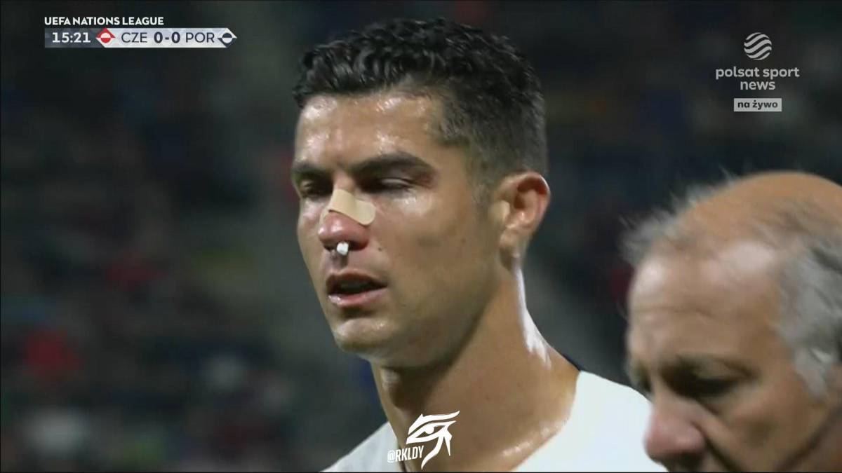 Los checos le dieron con todo: Cristiano Ronaldo sufre durísimo golpe que lo dejó tendido en el suelo y sangrando