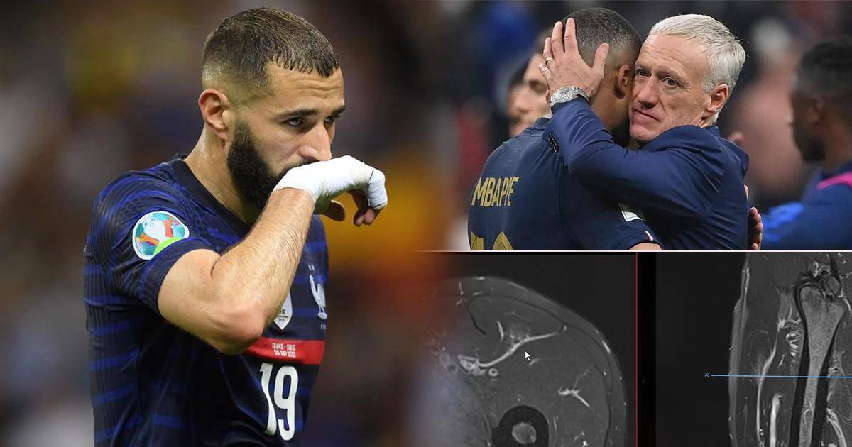 Benzema’s news points to Deschamps after his agent released evidence that he could play at the World Cup.