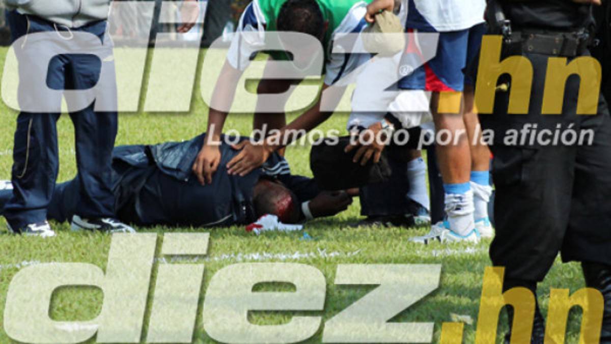 La brutal agresión a Gilberto Yearwood