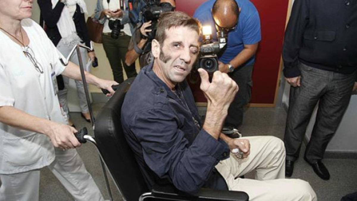 Así quedó el ojo del torero que recibió dramática embestida