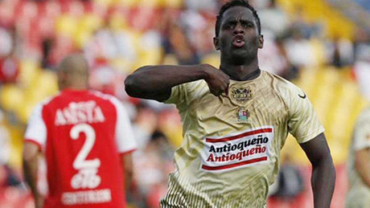 Futbolista le fractura en tres partes la cara a compañero en Colombia