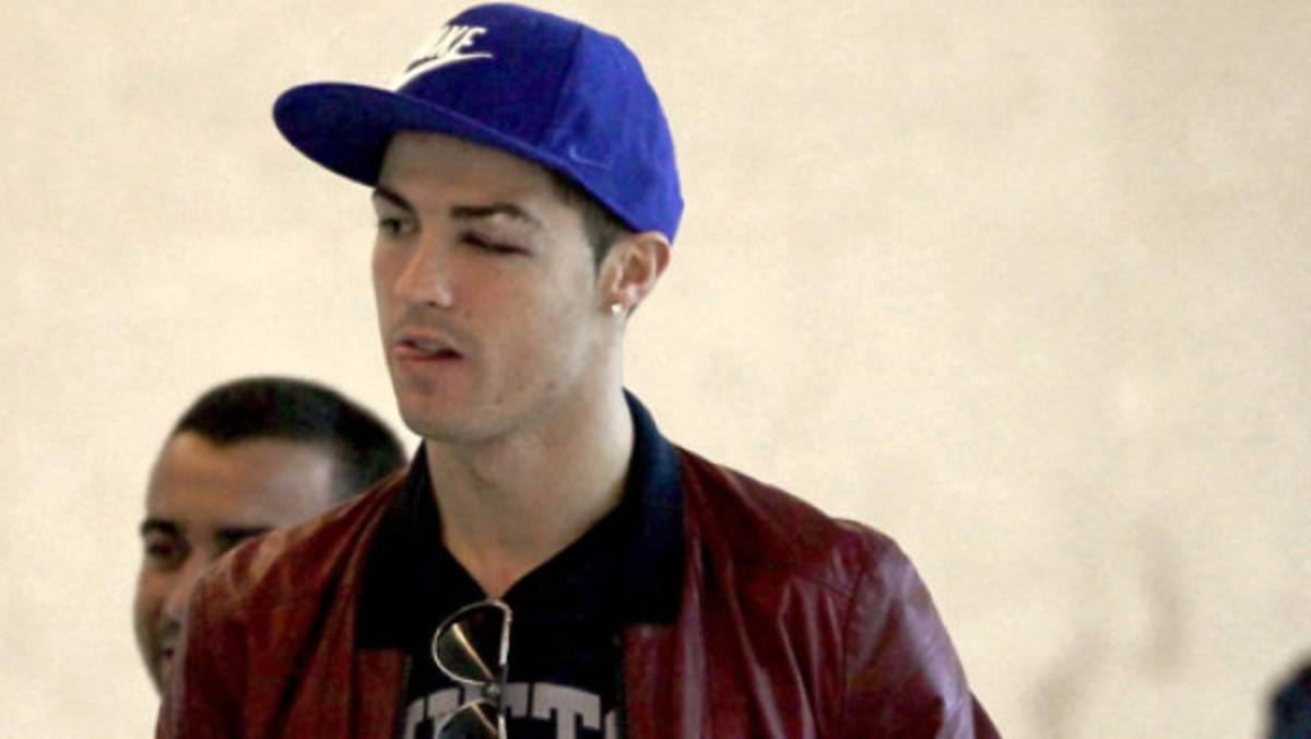 Portugal descarta a Cristiano Ronaldo por corte en la ceja