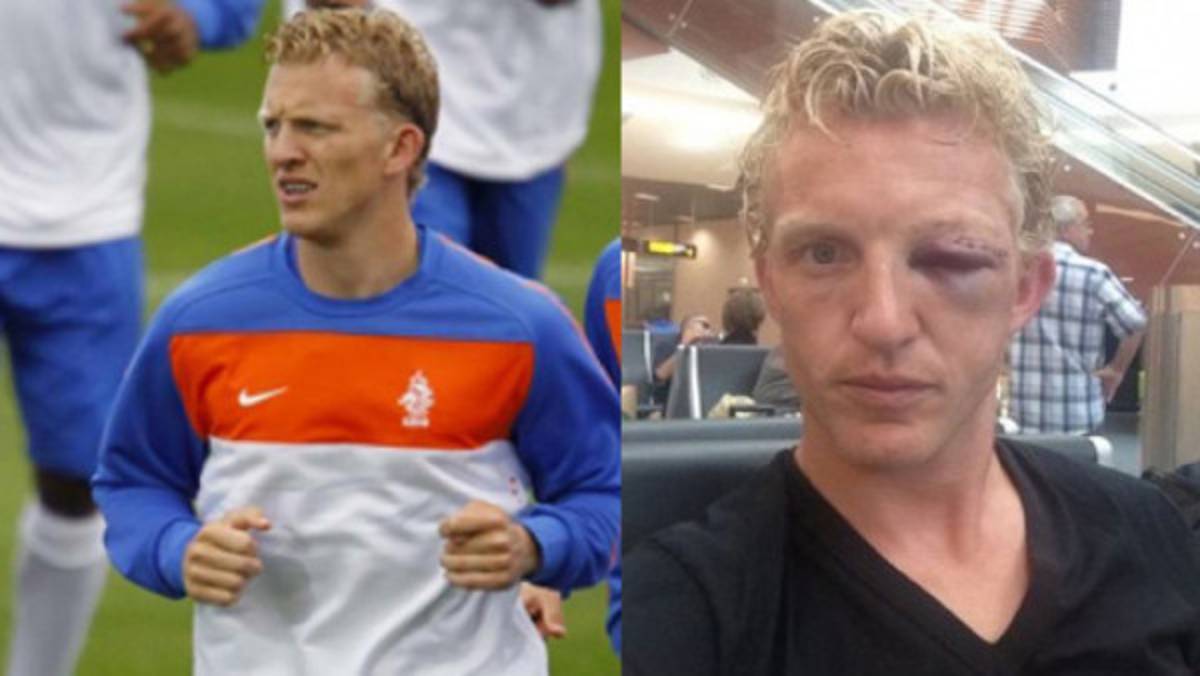 VIDEO: Tremendo choque entre futbolistas de Holanda