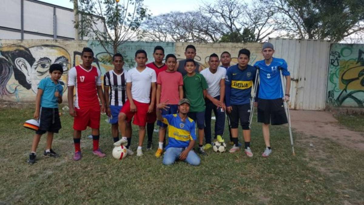 Luis Diego Jiménez, el futbolista hondureño que sonríe a pesar de haber perdido una pierna
