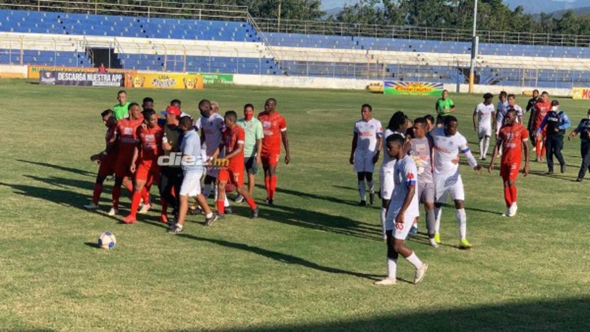 No se vio en TV: El 'chofer' de Olimpia, la nueva kinesióloga de UPNFM y Arboleda estalló por racismo