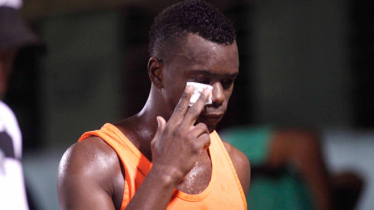 Erick Norales terminó con siete puntadas en el pómulo