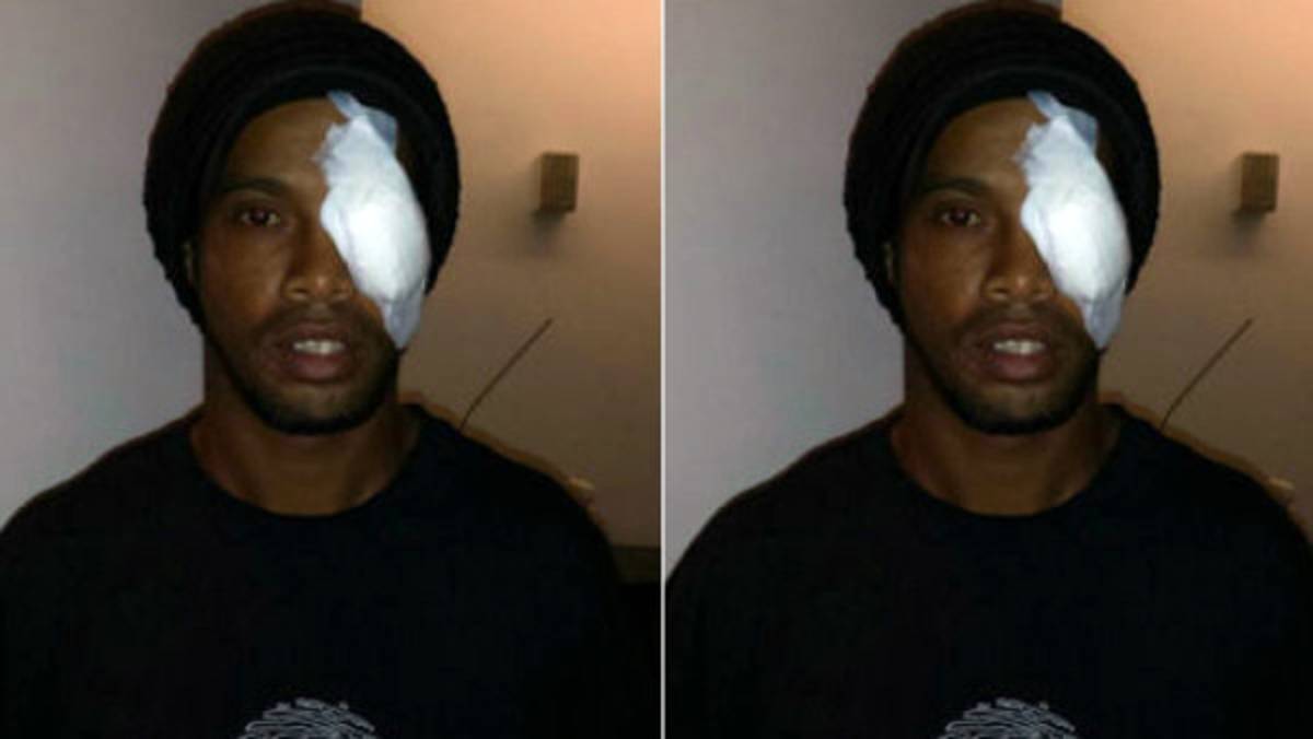 Ronaldinho luce parche en el ojo tras balonazo recibido en México