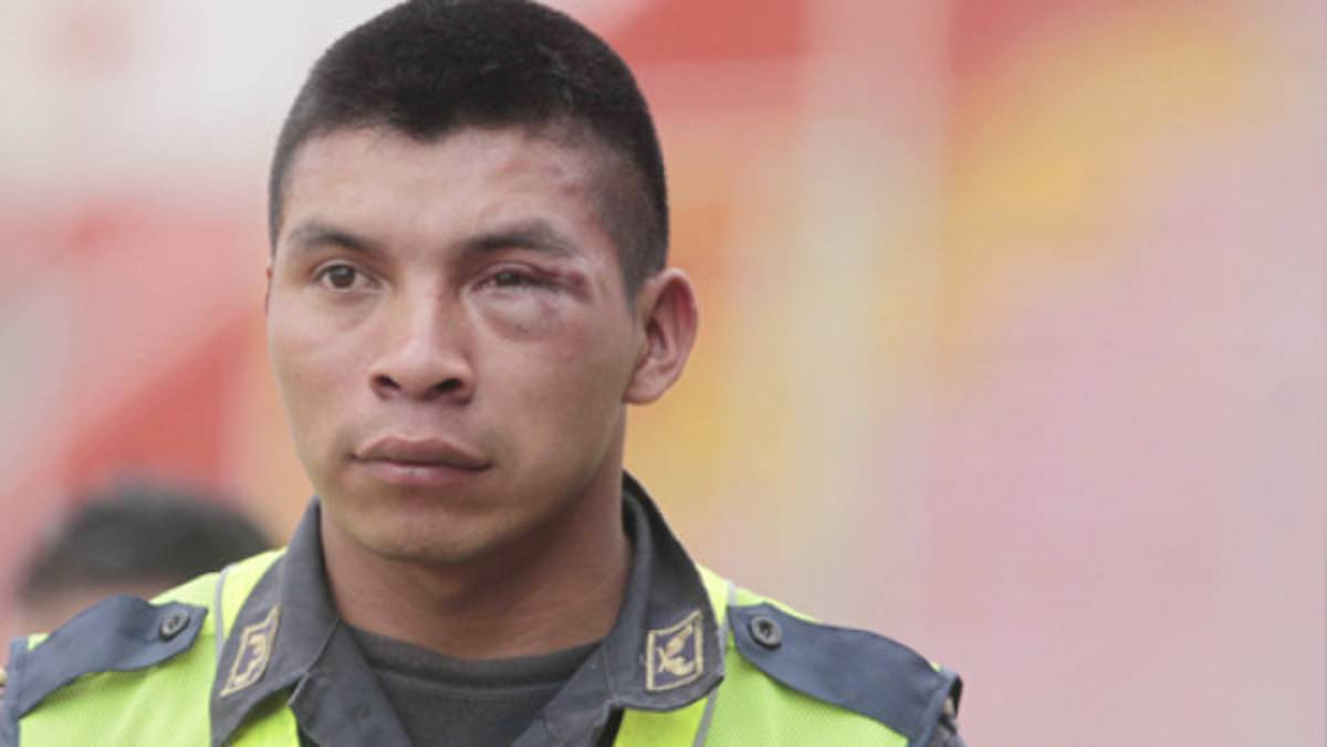 'Gracias a Dios no me acordé del arma, sino estuviera en el mamo”