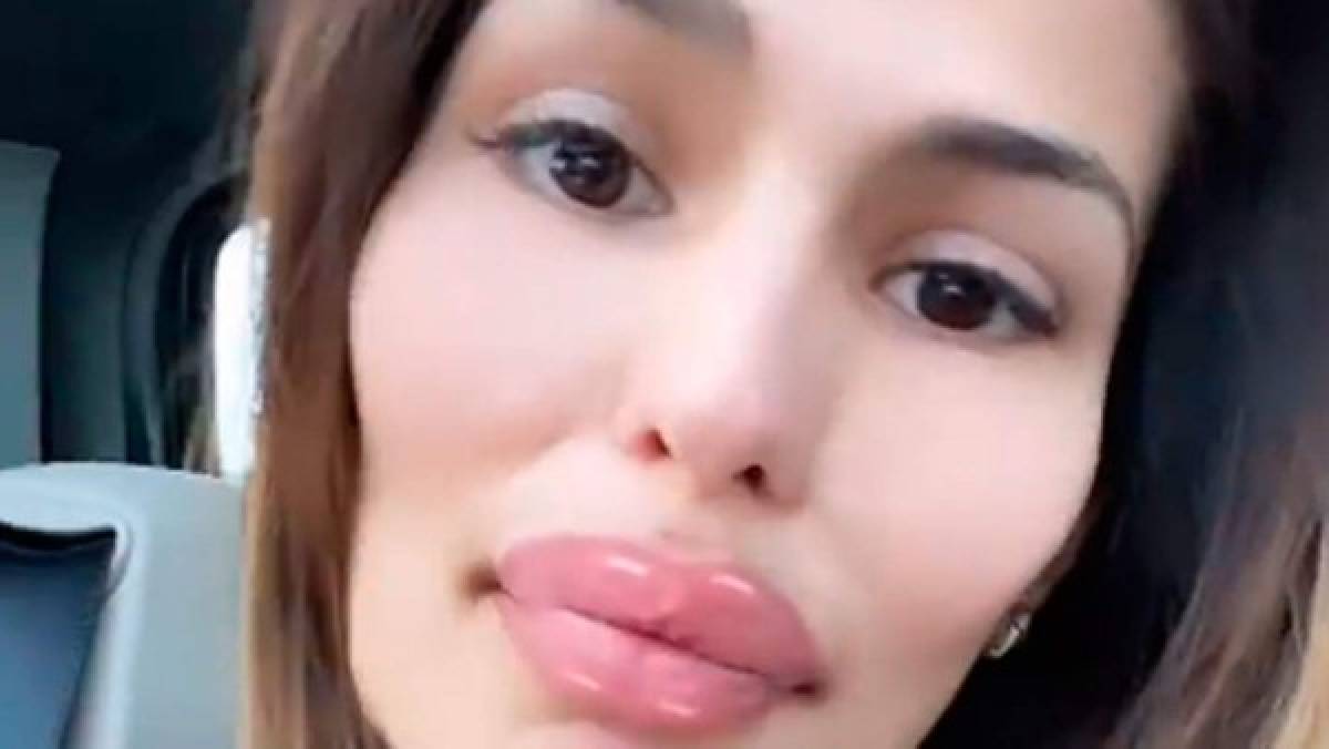 '¿Qué te ha pasado?' Mujer de crack del Real Madrid es atacada por su impactante aumento de labios  