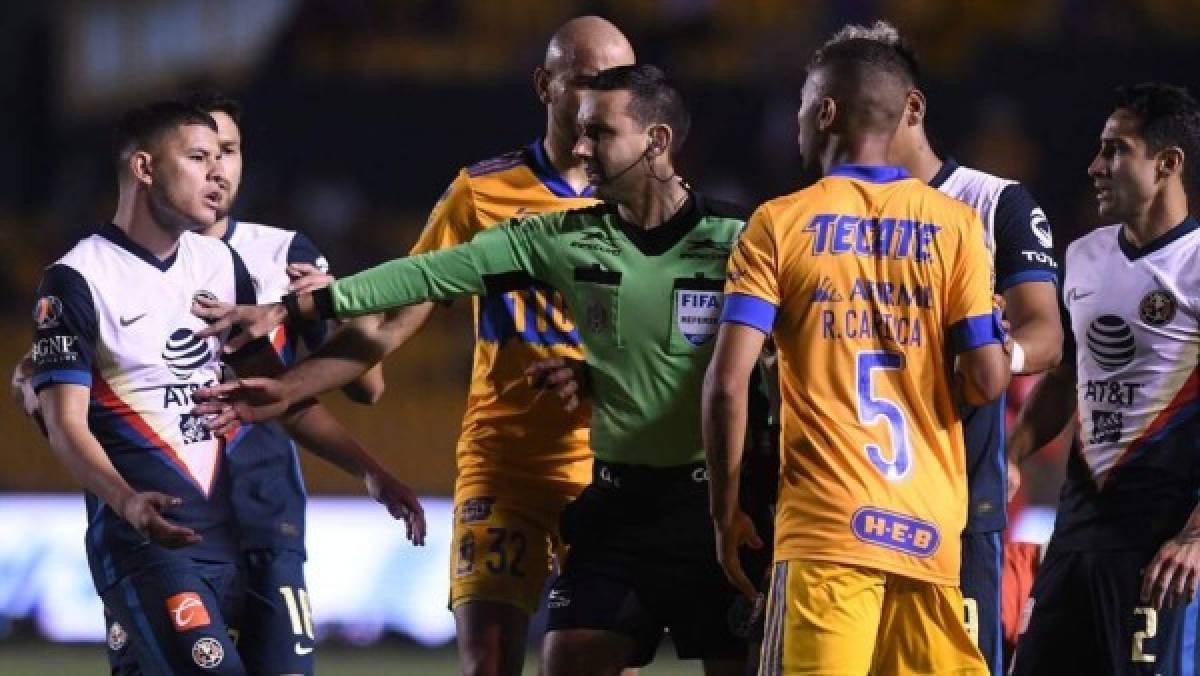 ''Juego de Barbies'': figura de Tigres explota y así quedó la pierna de jugador del América en la Liga MX