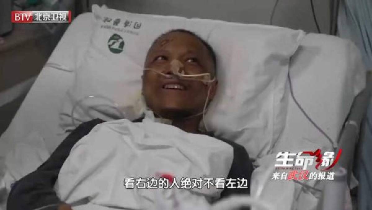 El terrible cambio de piel de dos médicos chinos sobrevivientes del coronavirus en Wuhan