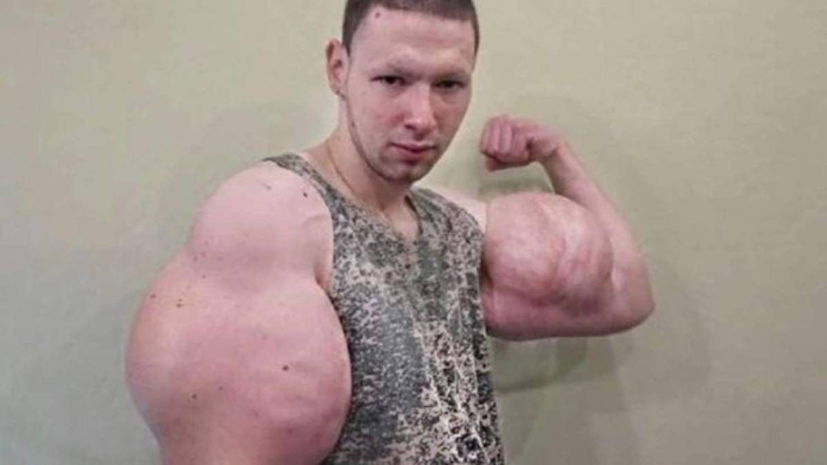 Así es el ''Popeye'' ruso, el luchador que fue humillado durante su debut en la MMA