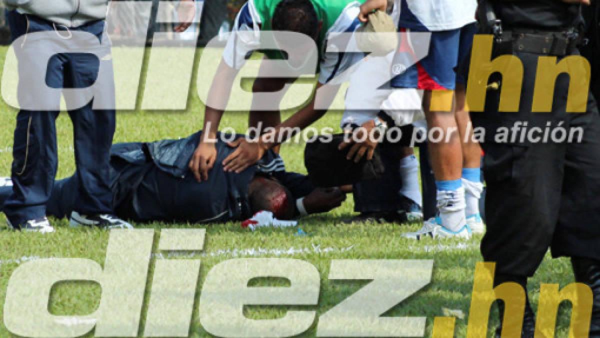 Lo bañaron de aceite quemado y fueron agredidos: varios hondureños también sufrieron racismo en Guatemala, Polonia, Italia y Austria