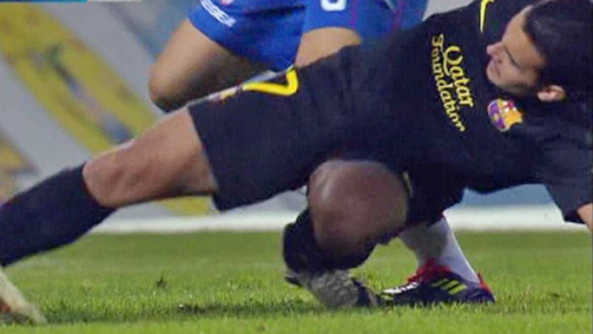 La dura lesión de Pedro con el Barcelona