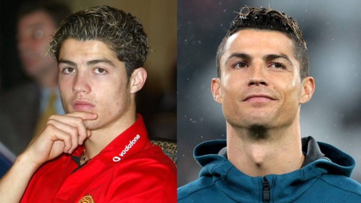 Cristiano Ronaldo: Desvelan las cinco cirugías que se realizó para cambiar su imagen