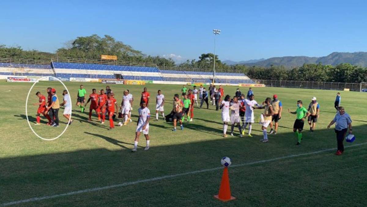 No se vio en TV: El 'chofer' de Olimpia, la nueva kinesióloga de UPNFM y Arboleda estalló por racismo