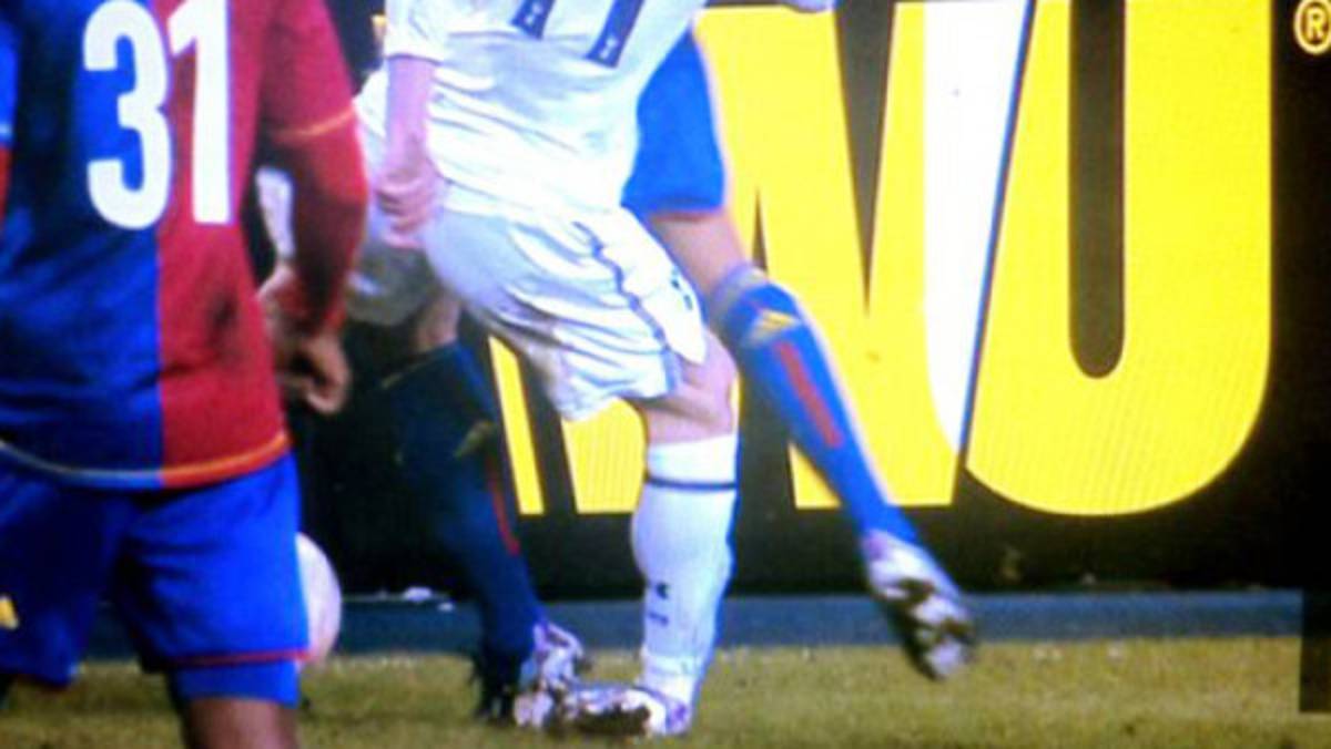 VIDEO: La fea lesión que sufrió Gareth Bale y que tiene preocupado al Tottenham