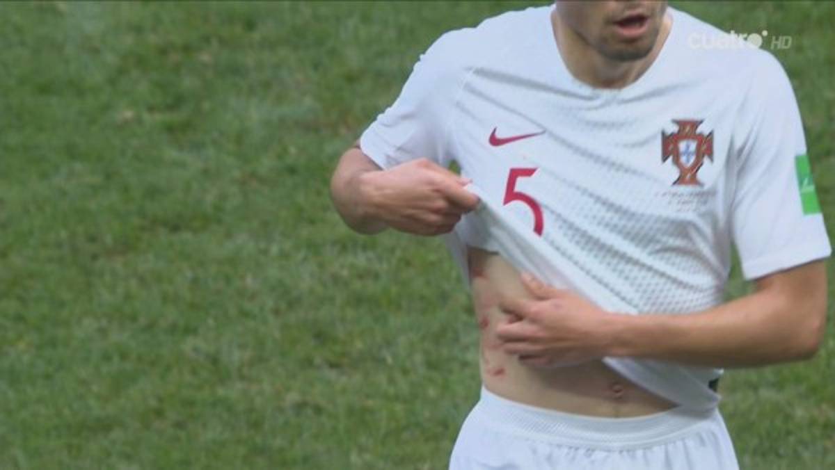 Destrozados: Las desgarradoras imágenes de marroquíes en Rusia y la felicidad de Cristiano