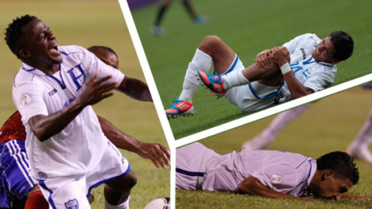 Las bajas que ya tiene Honduras ante Estados Unidos