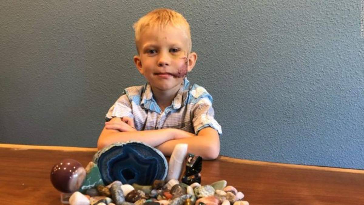 Arriesgó su vida para salvar a su hermana del brutal ataque de un perro y ahora fue reconocido por el Consejo Mundial del Boxeo