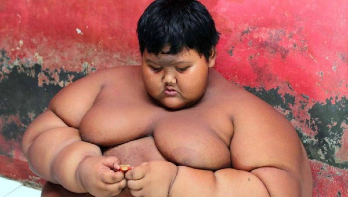 Impresionante: El tremendo cambio físico del niño más obeso del mundo que desea ser futbolista  