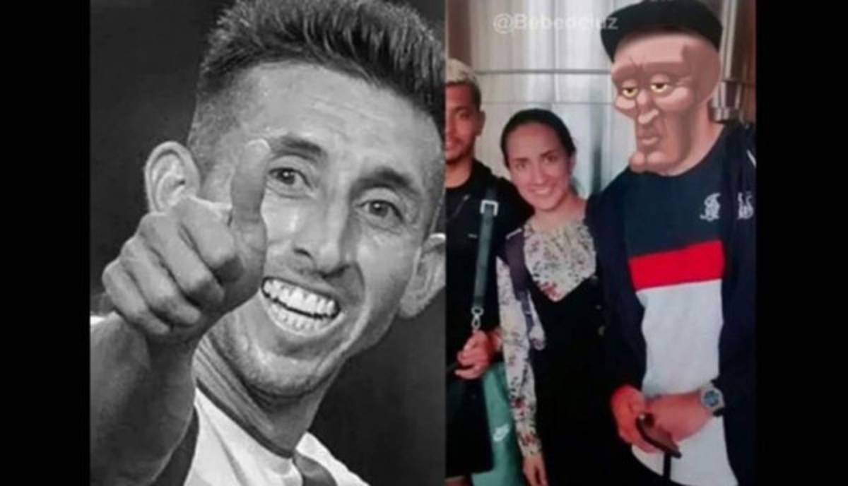 ¡Héctor Herrera es acribillado con memes tras sus cirugías plásticas!