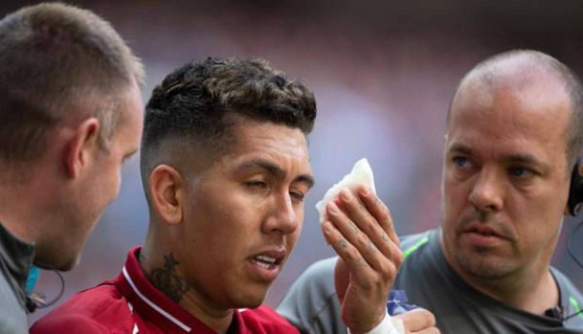 Curioso: Roberto Firmino entrena con anteojos al estilo Edgar Davids