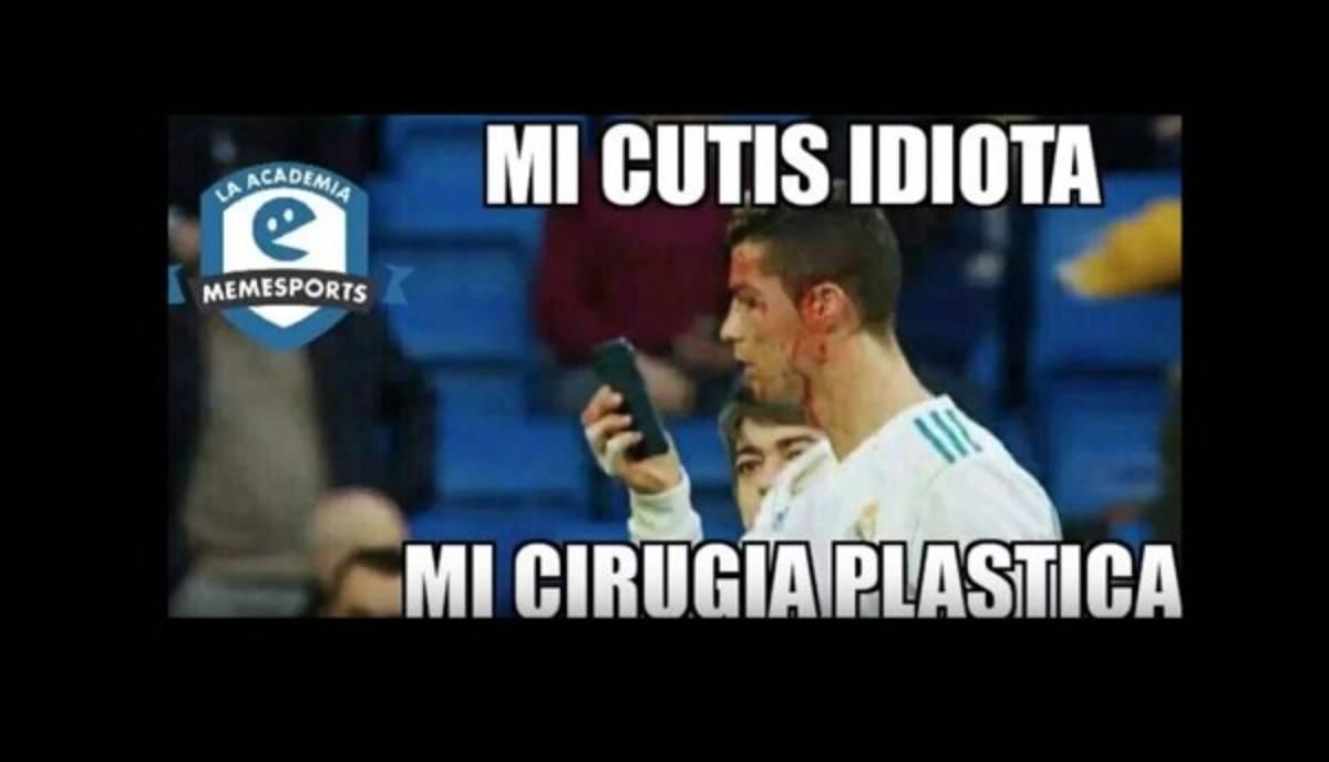 ¡VIRAL! Los memes de Cristiano Ronaldo por mirar su herida en el celular