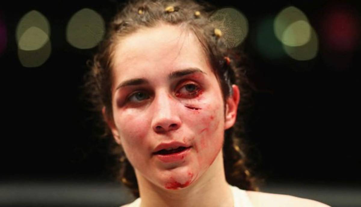 FOTOS: El antes y después de Verónica Macedo tras paliza en la UFC