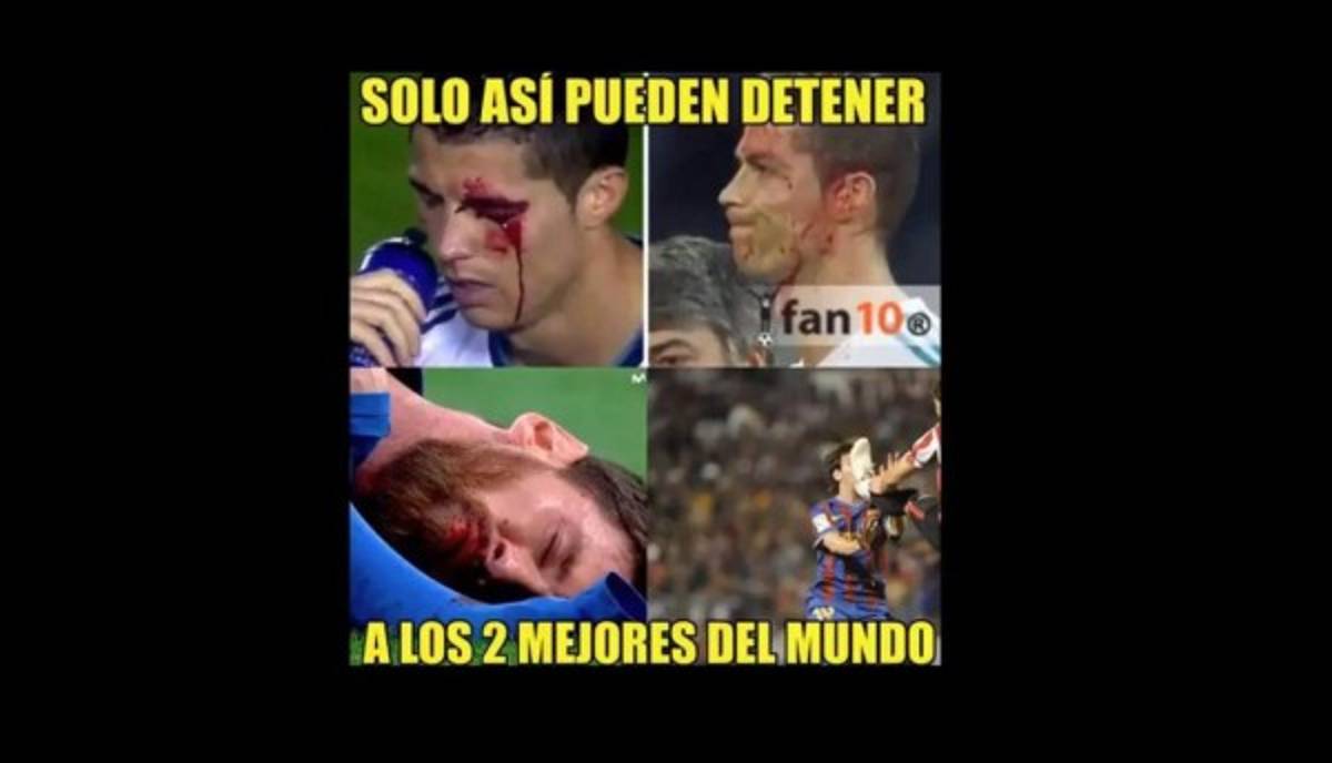 ¡VIRAL! Los memes de Cristiano Ronaldo por mirar su herida en el celular