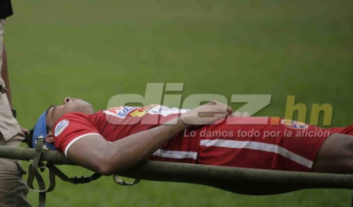 Sangre, abejas, chicas lindas y besos en las fotos curiosas de la fecha 7&nbsp;&nbsp;