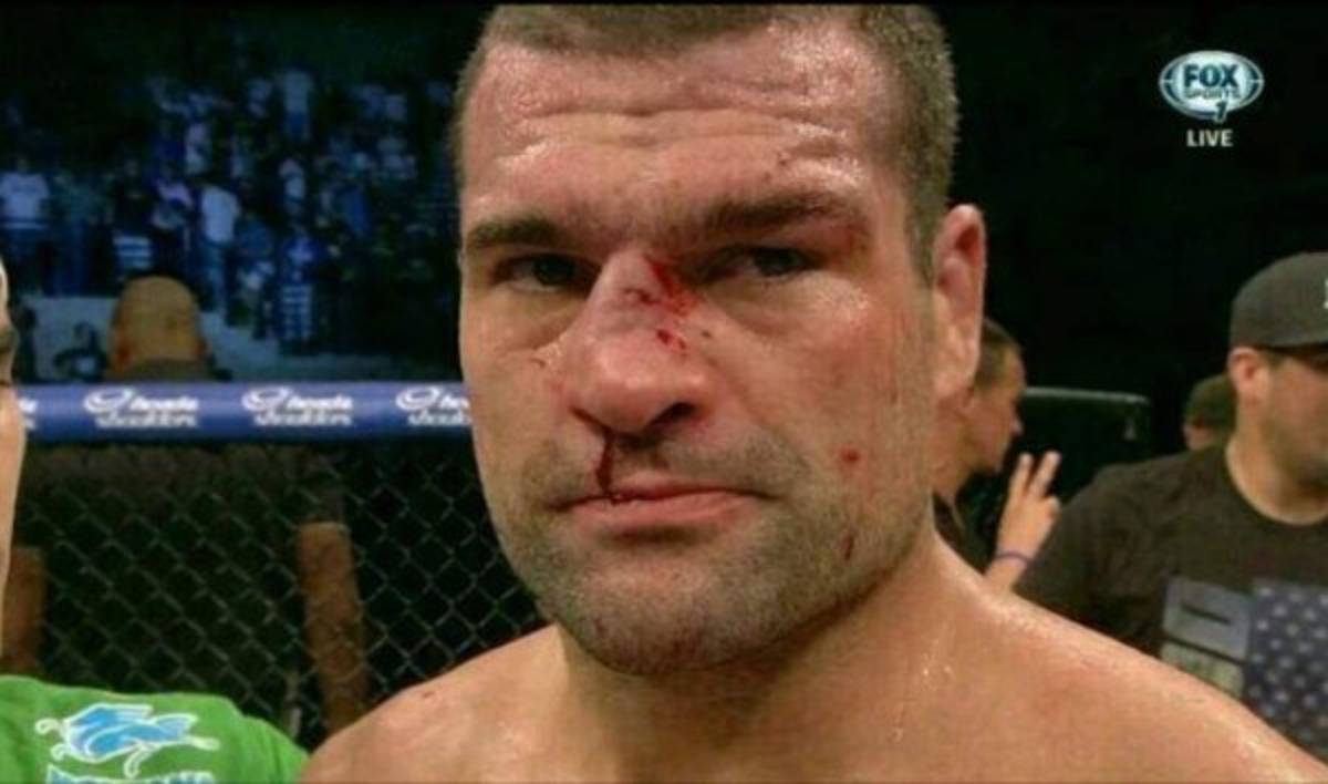 Fotos: Los golpes más espeluznantes en la UFC